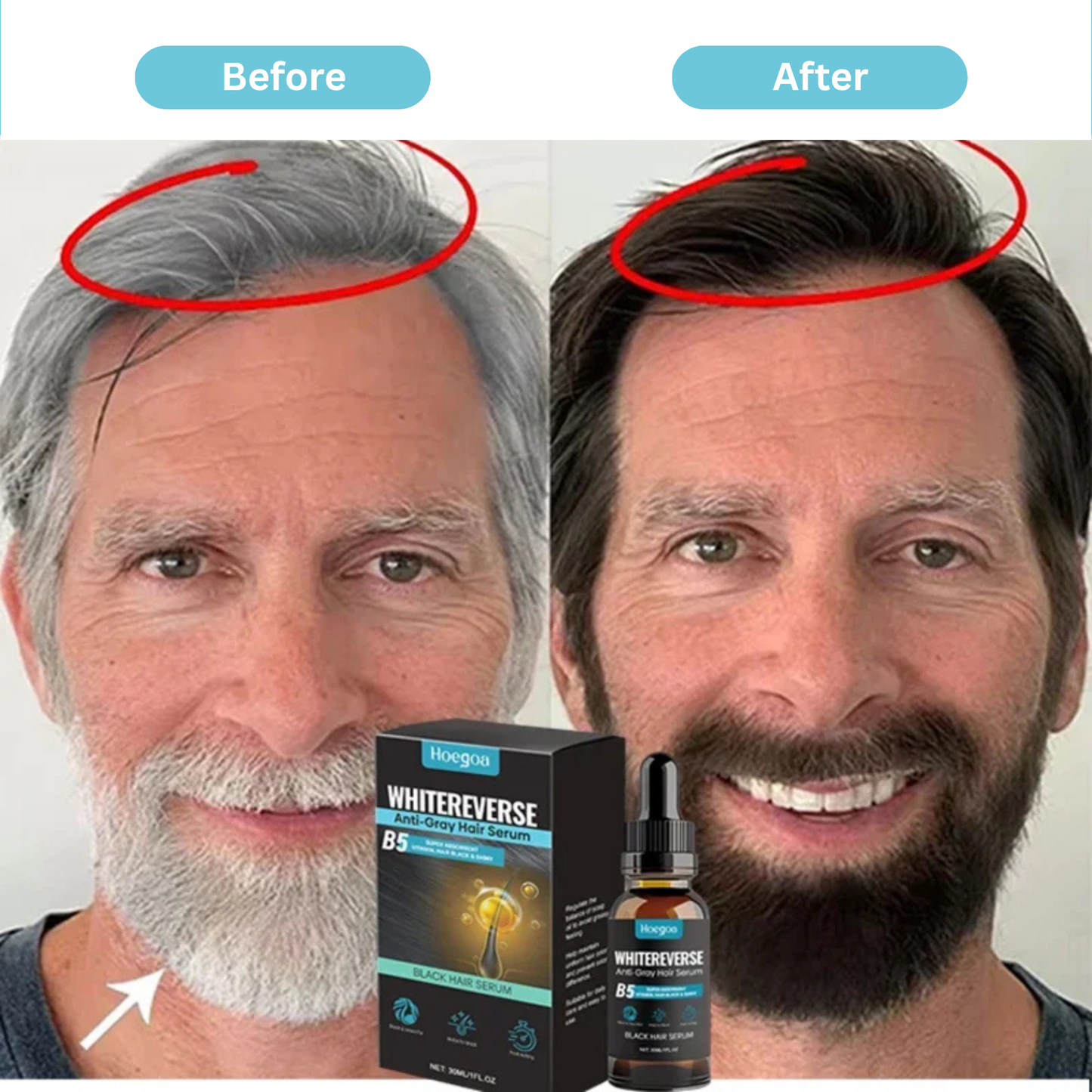 Repigment Hair Serum